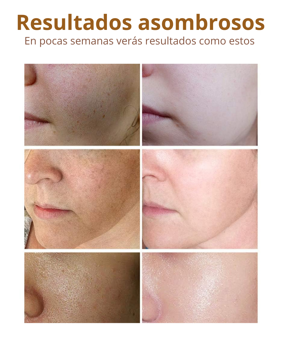 Set de Vitamina C DISAAR BEAUTY