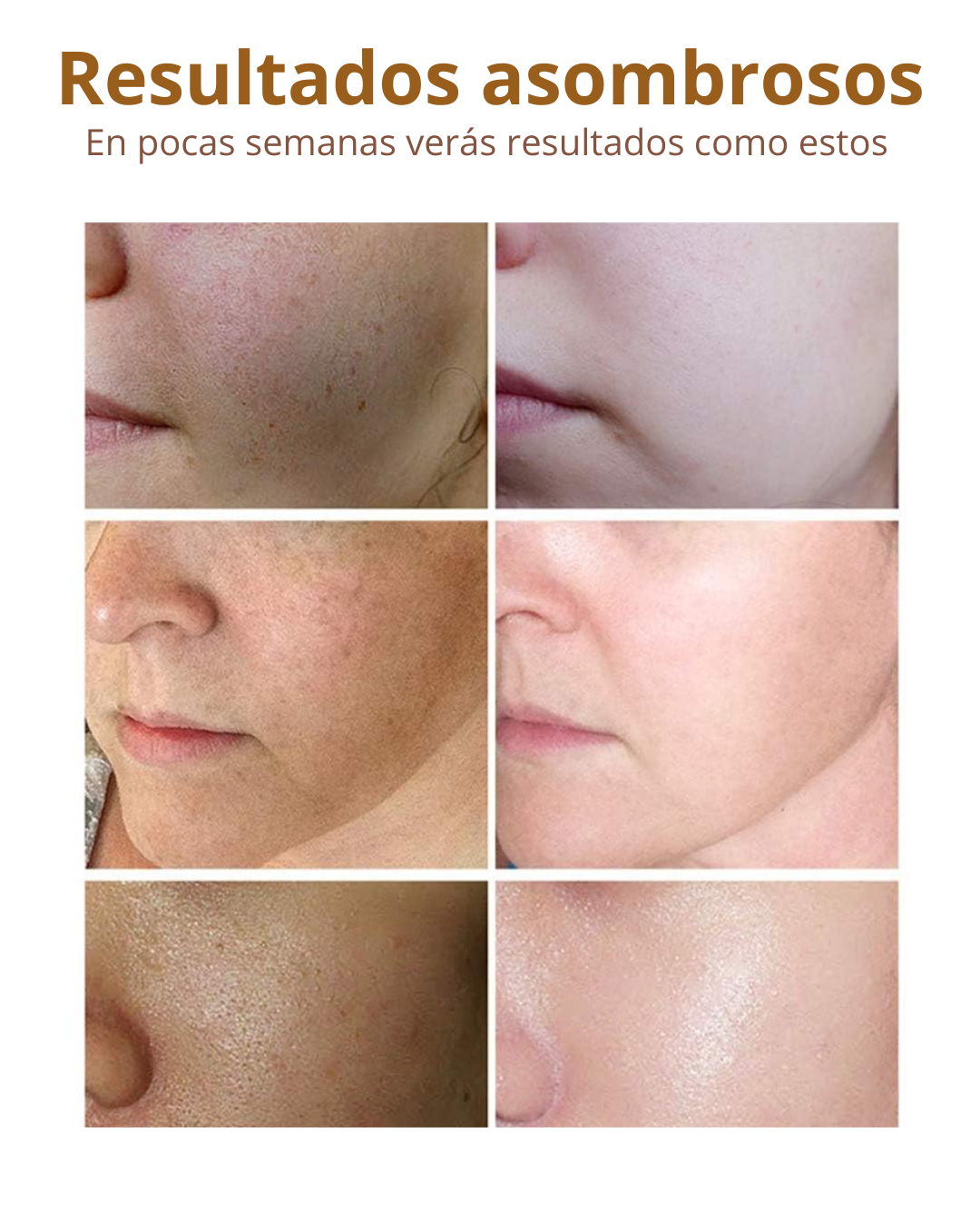 Set de Vitamina C DISAAR BEAUTY.